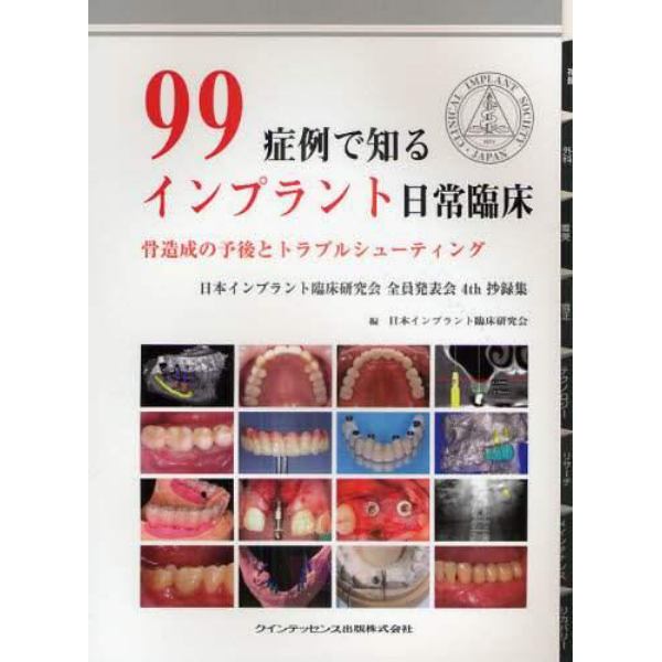 ９９症例で知るインプラント日常臨床　骨造成の予後とトラブルシューティング　日本インプラント臨床研究会全員発表会４ｔｈ抄録集