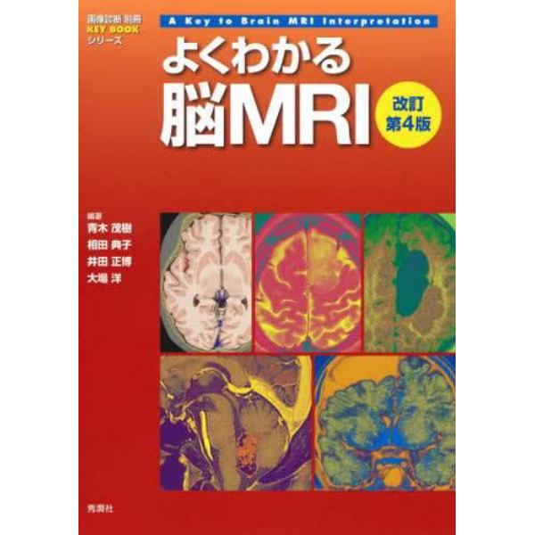 よくわかる脳ＭＲＩ