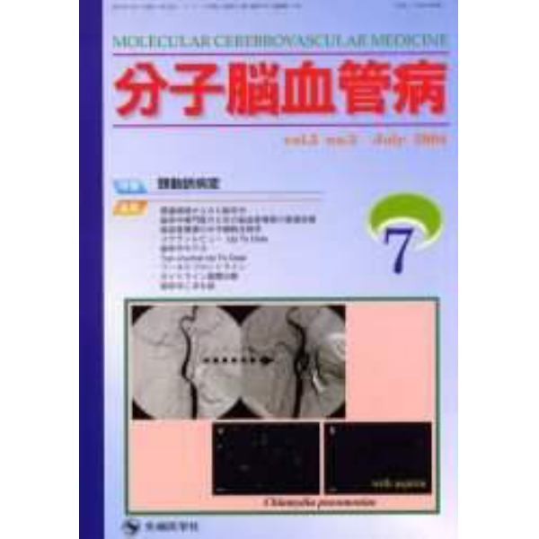 分子脳血管病　Ｖｏｌ．３Ｎｏ．３（２００４－７）