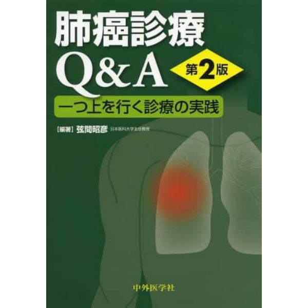 肺癌診療Ｑ＆Ａ　一つ上を行く診療の実践