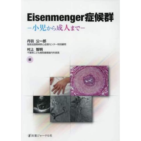 Ｅｉｓｅｎｍｅｎｇｅｒ症候群　小児から成人まで