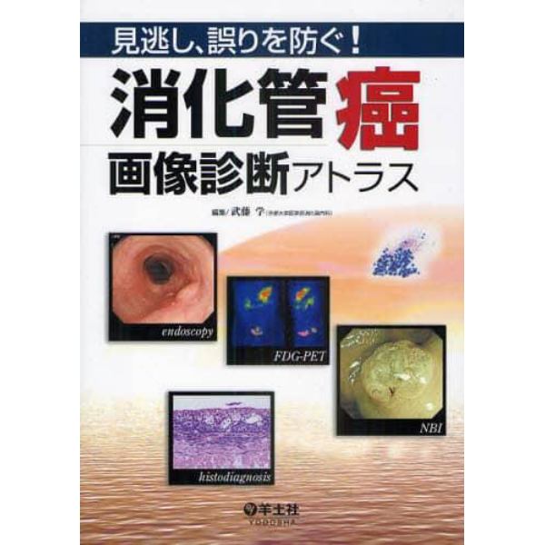 見逃し、誤りを防ぐ！消化管癌画像診断アトラス