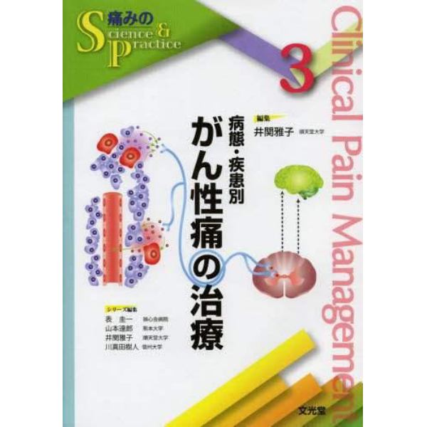 病態・疾患別がん性痛の治療