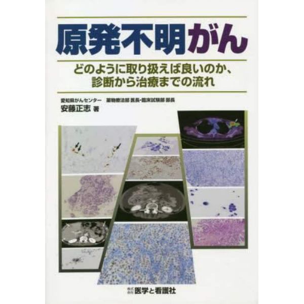 原発不明がん　どのように取り扱えば良いのか、診断から治療までの流れ