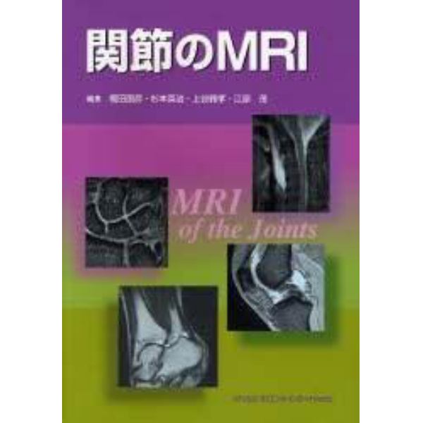 関節のＭＲＩ