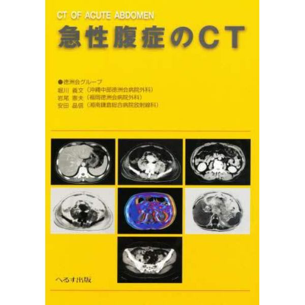 急性腹症のＣＴ