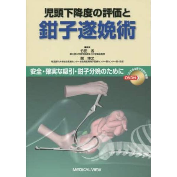 児頭下降度の評価と鉗子遂娩術　安全・確実な吸引・鉗子分娩のために