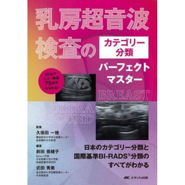 乳房超音波検査のカテゴリー分類パーフェクトマスター　日本のカテゴリー分類と国際基準ＢＩ－ＲＡＤＳ分類のすべてがわかる