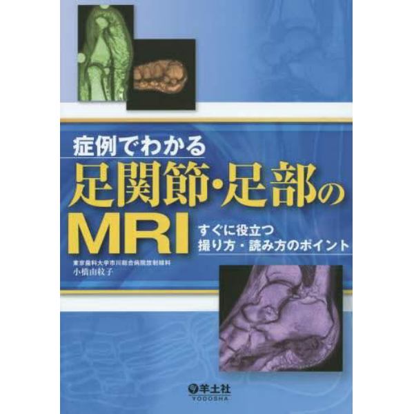 症例でわかる足関節・足部のＭＲＩ　すぐに役立つ撮り方・読み方のポイント