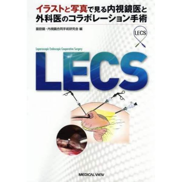 ＬＥＣＳ　イラストと写真で見る内視鏡医と外科医のコラボレーション手術