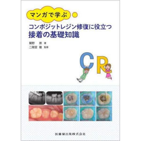 マンガで学ぶコンポジットレジン修復に役立つ接着の基礎知識