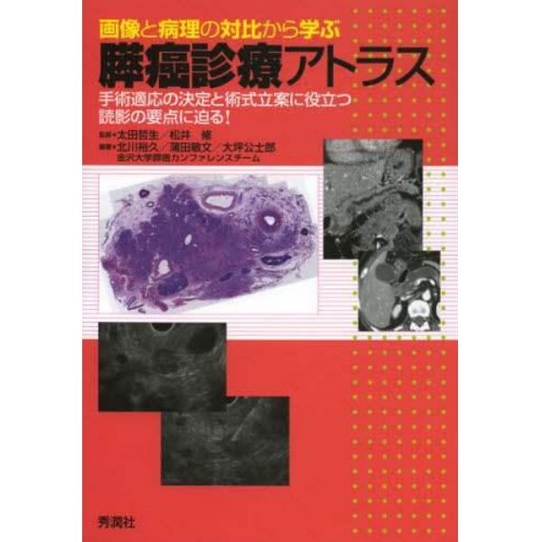 画像と病理の対比から学ぶ膵癌診療アトラス　手術適応の決定と術式立案に役立つ読影の要点に迫る！