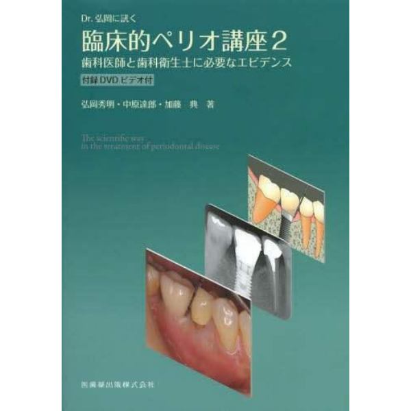 Ｄｒ．弘岡に訊く臨床的ペリオ講座　２