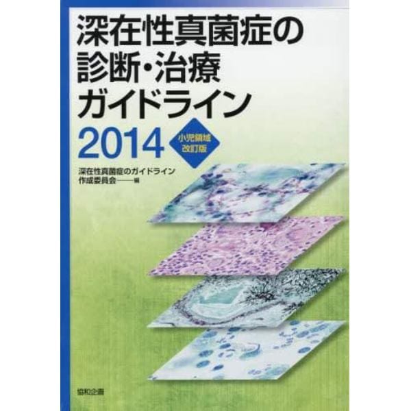 深在性真菌症の診断・治療ガイドライン　２０１４