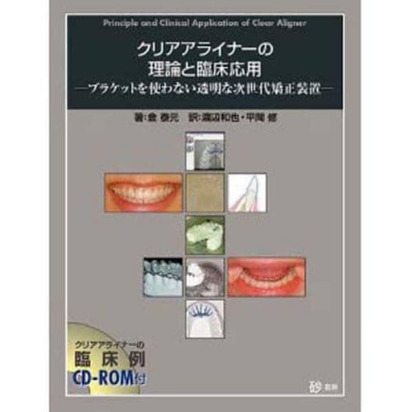 クリアアライナーの理論と臨床応用