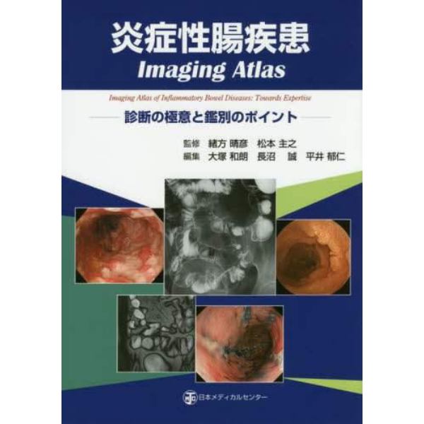 炎症性腸疾患Ｉｍａｇｉｎｇ　Ａｔｌａｓ　診断の極意と鑑別のポイント