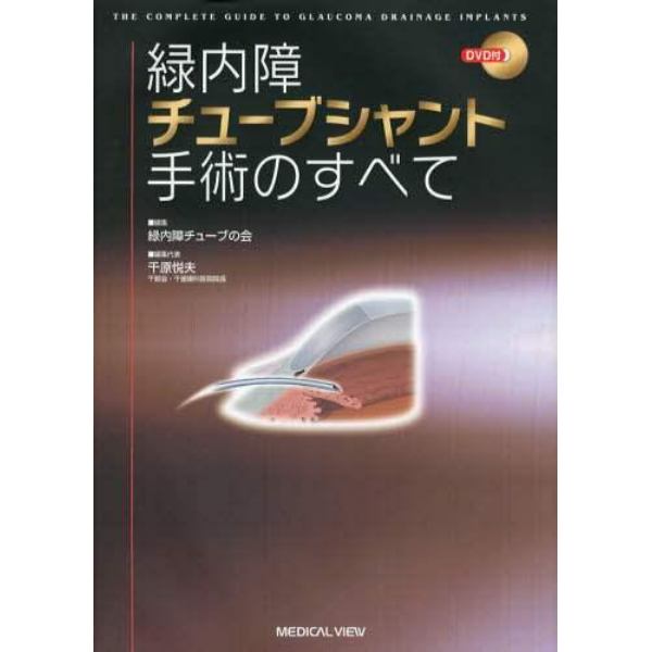 緑内障チューブシャント手術のすべて