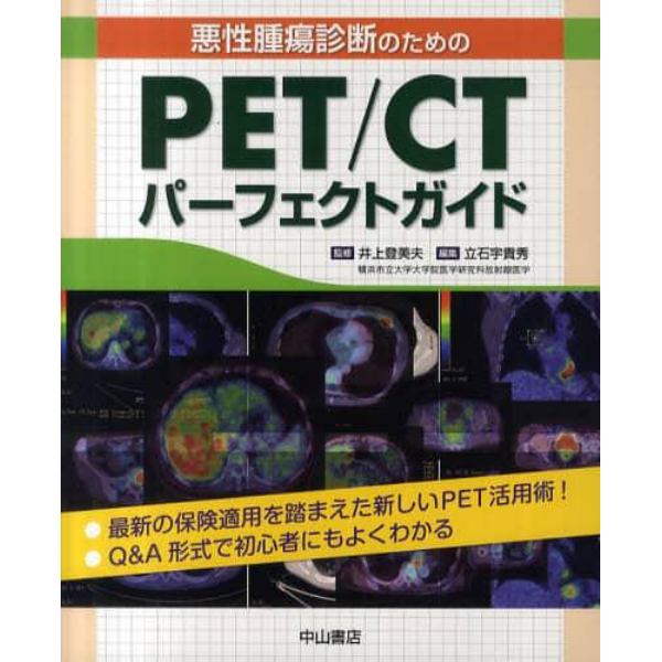 悪性腫瘍診断のためのＰＥＴ／ＣＴパーフェクトガイド