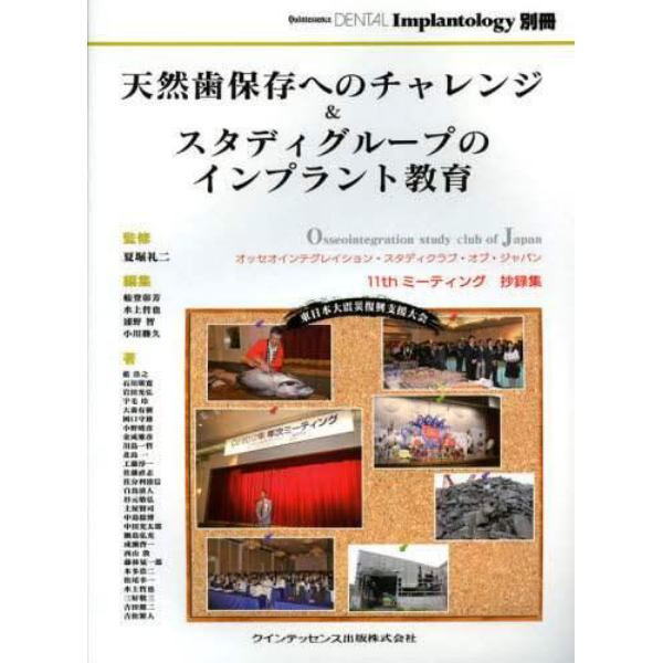 天然歯保存へのチャレンジ＆スタディグループのインプラント教育