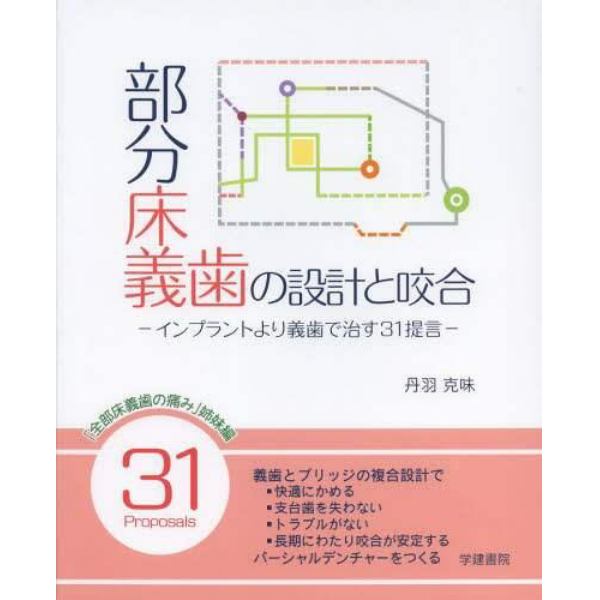 部分床義歯の設計と咬合　インプラントより義歯で治す３１提言