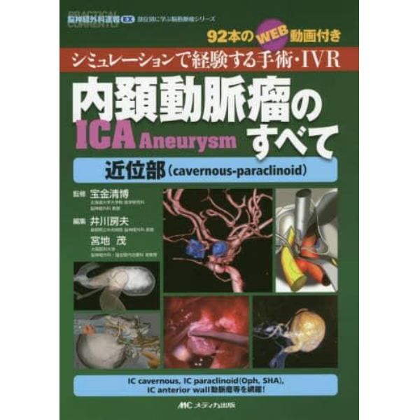 内頚動脈瘤ＩＣＡ　Ａｎｅｕｒｙｓｍのすべて近位部〈ｃａｖｅｒｎｏｕｓ‐ｐａｒａｃｌｉｎｏｉｄ〉　シミュレーションで経験する手術・ＩＶＲ　９２本のＷＥＢ動画付き