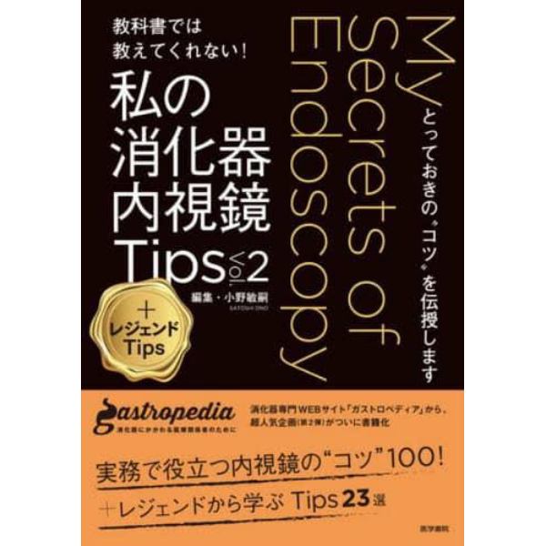 教科書では教えてくれない！私の消化器内視鏡Ｔｉｐｓ　とっておきの“コツ”を伝授します　Ｖｏｌ．２