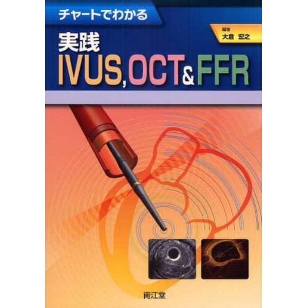 チャートでわかる実践ＩＶＵＳ，ＯＣＴ＆ＦＦＲ