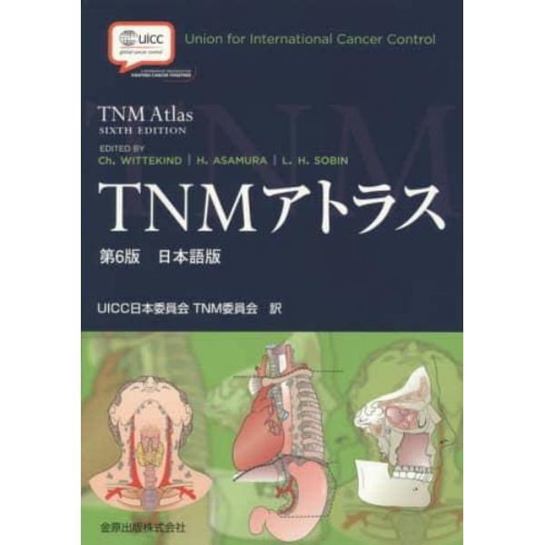 ＴＮＭアトラス　日本語版　イラストで理解する悪性腫瘍のＴＮＭ分類