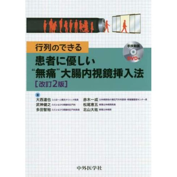 行列のできる患者に優しい“無痛”大腸内視鏡挿入法