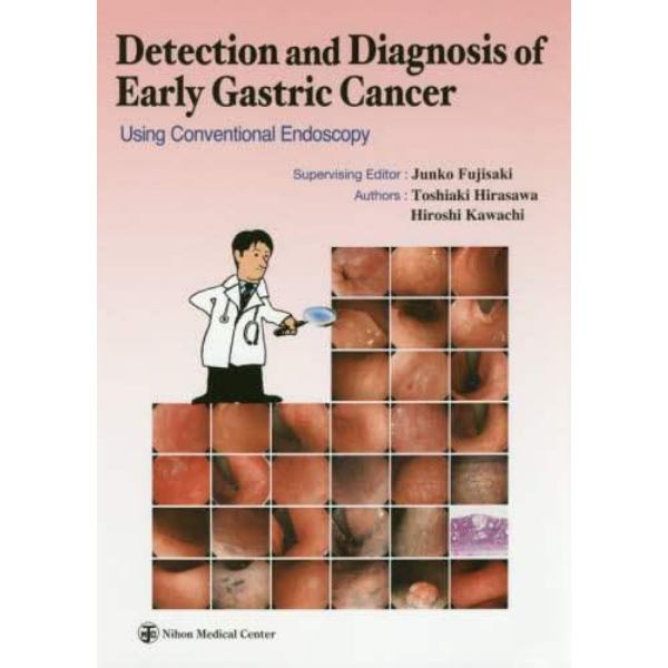 通常内視鏡観察による早期胃癌の拾い上げと診断　英語版