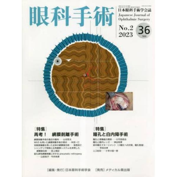 眼科手術　日本眼科手術学会誌　Ｖｏｌ．３６Ｎｏ．２（２０２３）