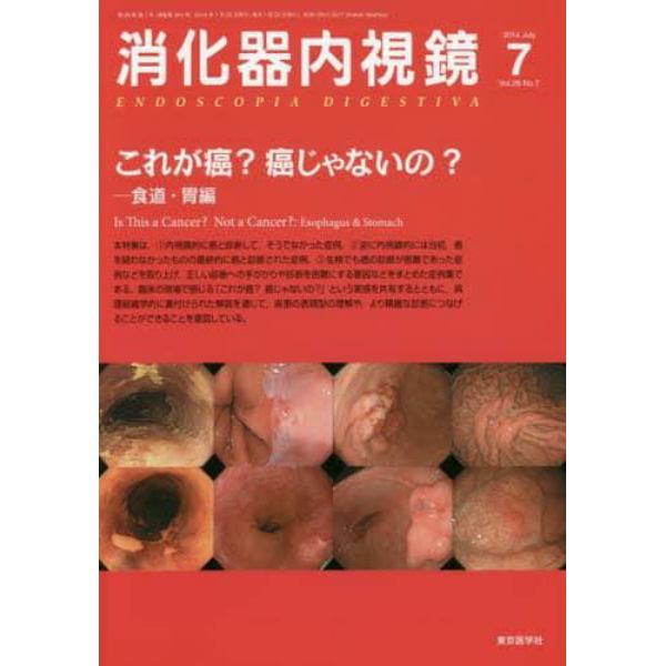 消化器内視鏡　Ｖｏｌ．２６Ｎｏ．７（２０１４Ｊｕｌｙ）