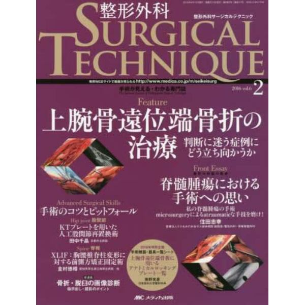 整形外科サージカルテクニック　手術が見える・わかる専門誌　第６巻２号（２０１６－２）