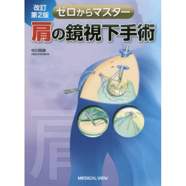 ゼロからマスター肩の鏡視下手術