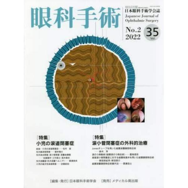 眼科手術　日本眼科手術学会誌　Ｖｏｌ．３５Ｎｏ．２（２０２２）