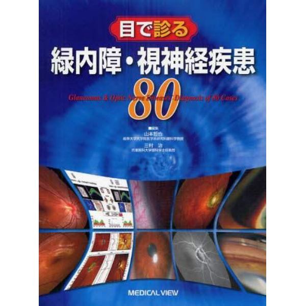 目で診る緑内障・視神経疾患８０
