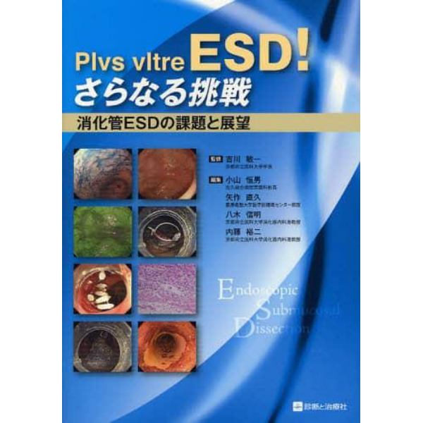 Ｐｌｖｓ　ｖｌｔｒｅ　ＥＳＤ！さらなる挑戦　消化管ＥＳＤの課題と展望