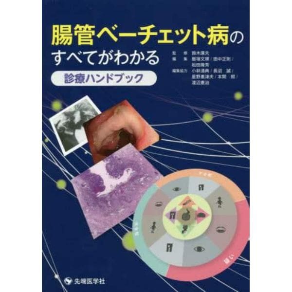 腸管ベーチェット病のすべてがわかる診療ハンドブック