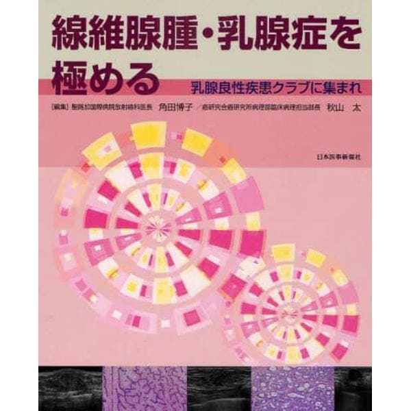 線維腺腫・乳腺症を極める　乳腺良性疾患クラブに集まれ