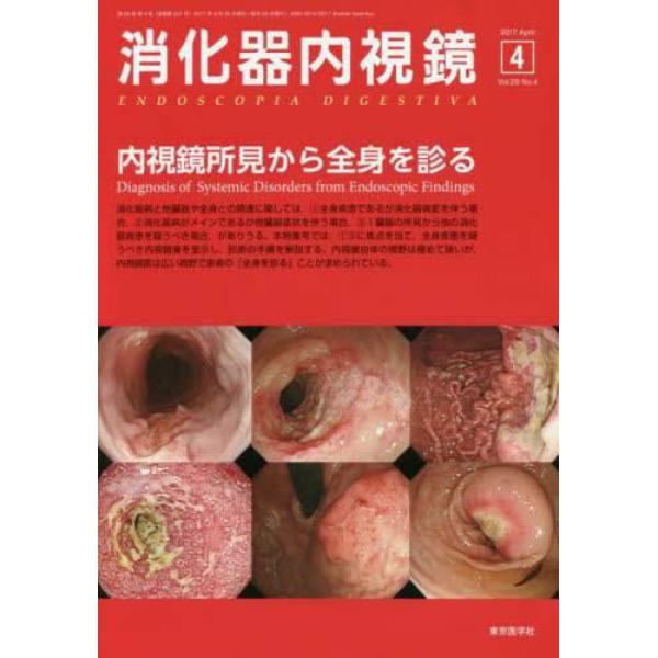 消化器内視鏡　Ｖｏｌ．２９Ｎｏ．４（２０１７Ａｐｒｉｌ）