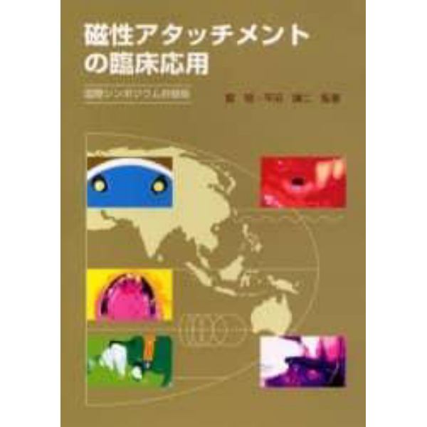 磁性アタッチメントの臨床応用　国際シンポジウム抄録版