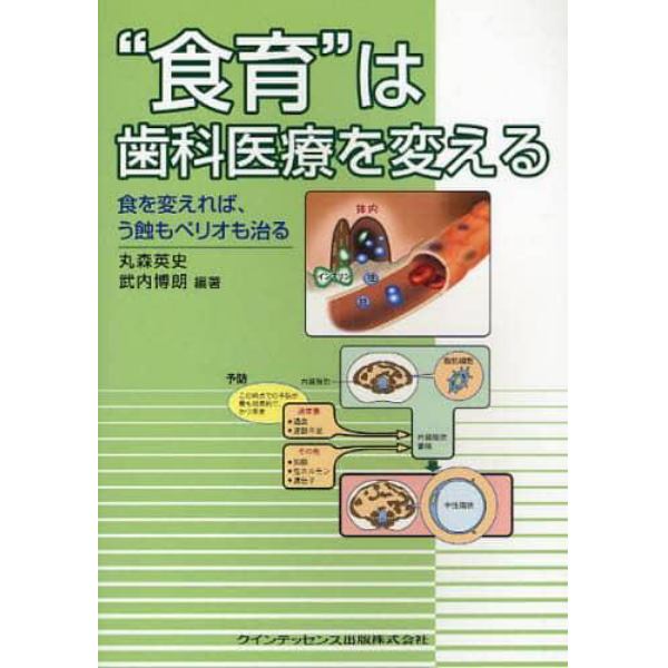 “食育”は歯科医療を変える　食を変えれば、う蝕もペリオも治る