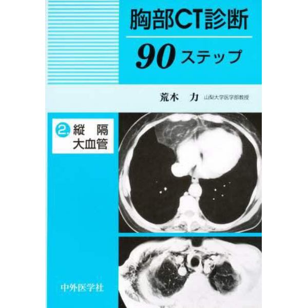 胸部ＣＴ診断９０ステップ　２