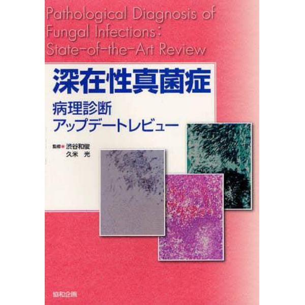 深在性真菌症　病理診断アップデートレビュー