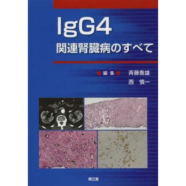 ＩｇＧ４関連腎臓病のすべて