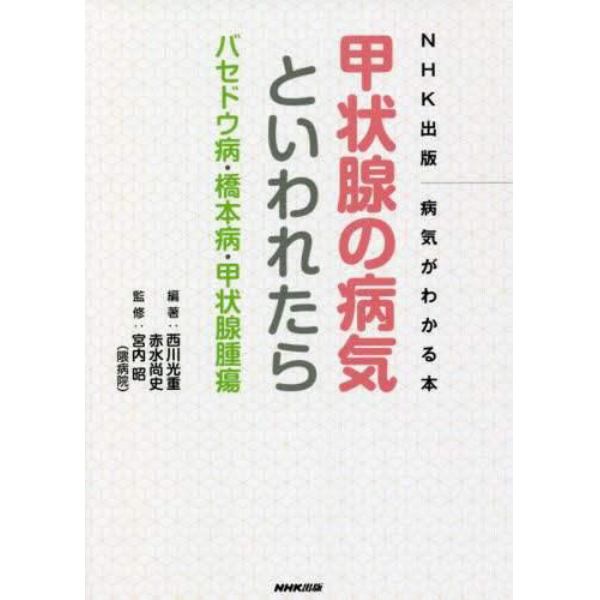 甲状腺の病気といわれたら　バセドウ病・橋本病・甲状腺腫瘍