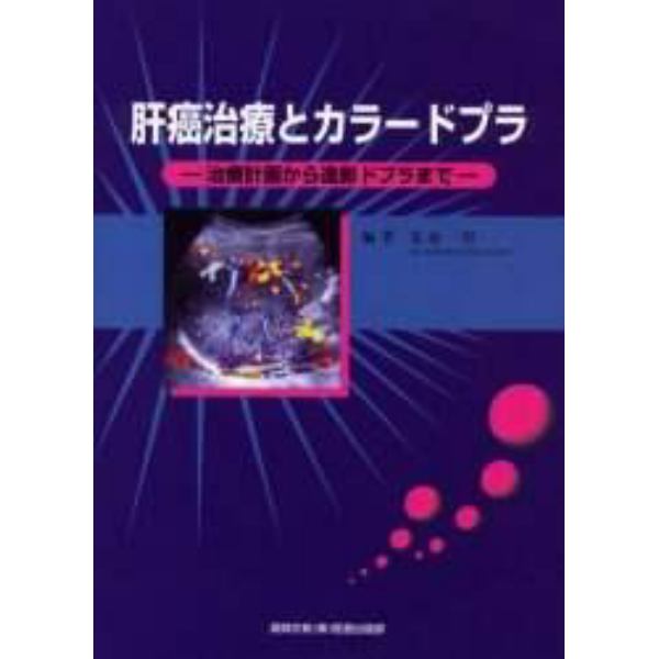 肝癌治療とカラードプラ　治療計画から造影ドプラまで