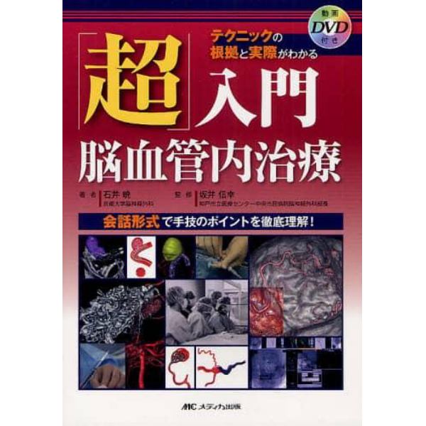 「超」入門脳血管内治療　テクニックの根拠と実際がわかる　会話形式で手技のポイントを徹底理解！