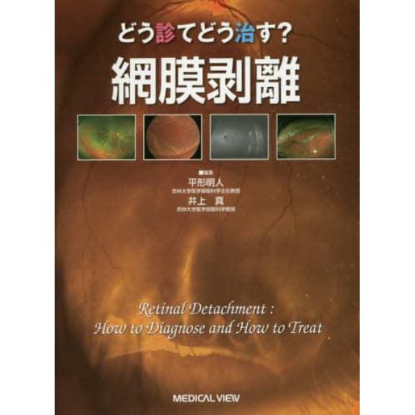 どう診てどう治す？網膜剥離