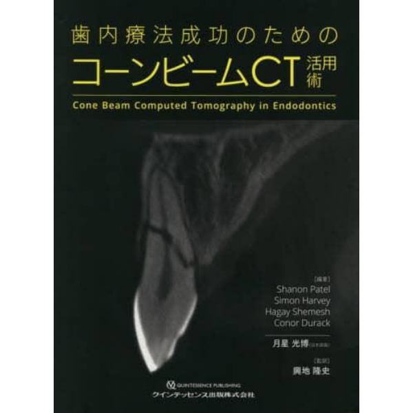 歯内療法成功のためのコーンビームＣＴ活用術